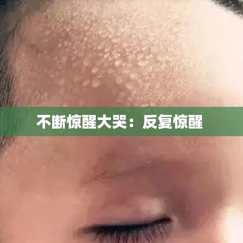 不斷驚醒大哭：反復(fù)驚醒 