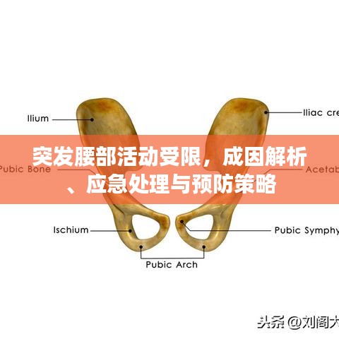 突發(fā)腰部活動受限，成因解析、應(yīng)急處理與預(yù)防策略