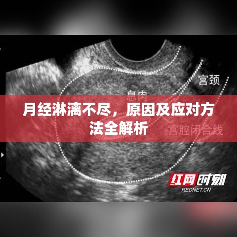 月經(jīng)淋漓不盡，原因及應(yīng)對(duì)方法全解析