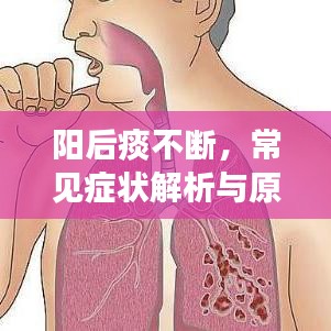 陽后痰不斷，常見癥狀解析與原因探究