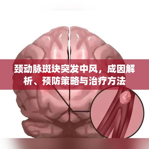 頸動脈斑塊突發(fā)中風，成因解析、預防策略與治療方法